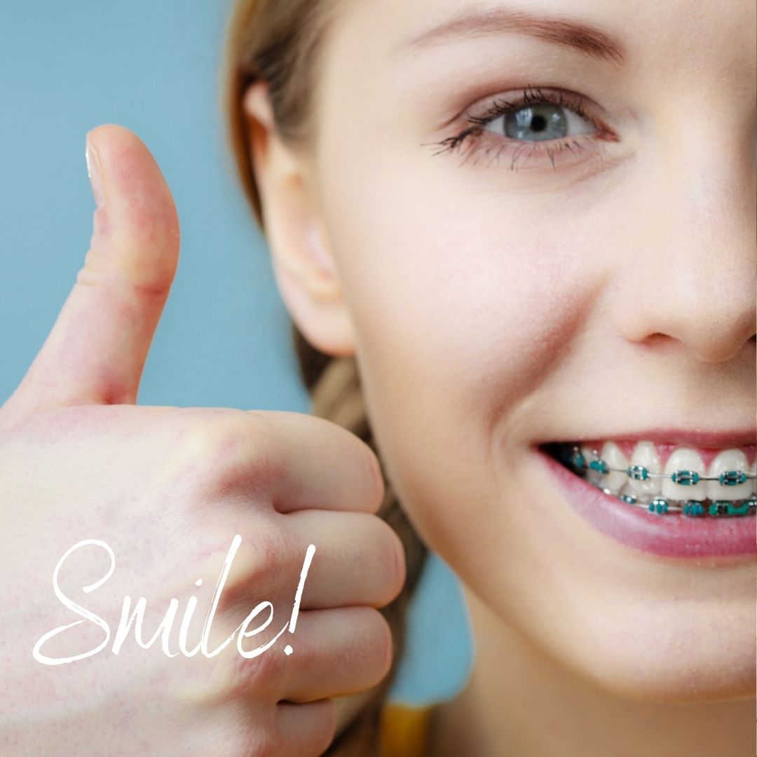 Braces and Oral Hygiene: How to Brush Properly for Best Results